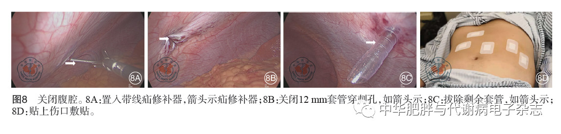 哪些医院可以做借卵试管婴儿III(黑龙江大庆哪些医院可以做借卵试管婴儿III)