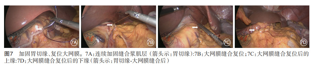 中国首个全球权威赠卵私立代怀试管绿色通道在广东启动