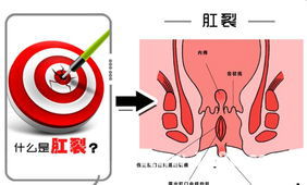 人为啥要做赠卵试管婴儿