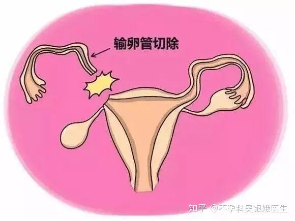 试管婴儿属于什么科室