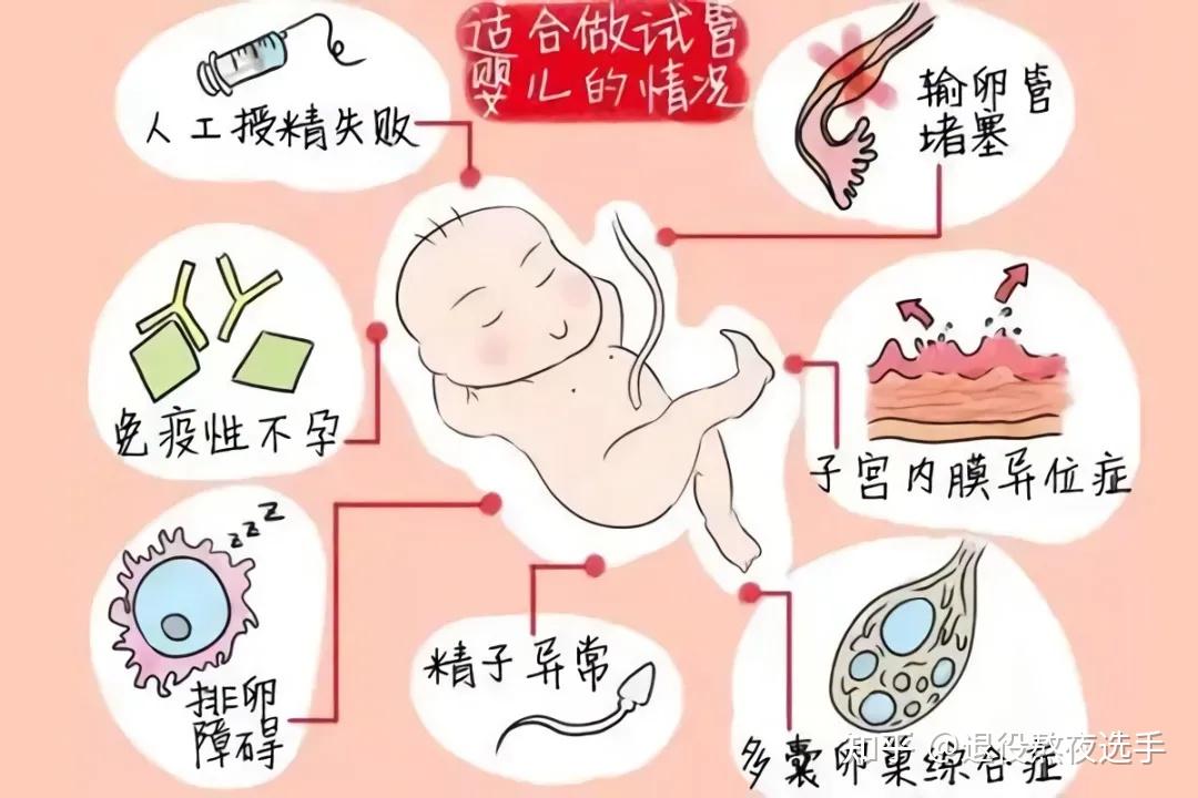 试管移植自然周期是什么意思