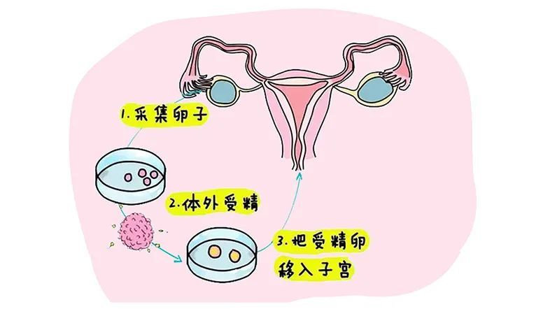 所有的不孕不育都可以人工试管代怀费用详解吗？