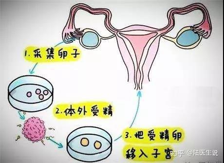 所有的不孕不育都可以人工试管代怀费用详解吗？
