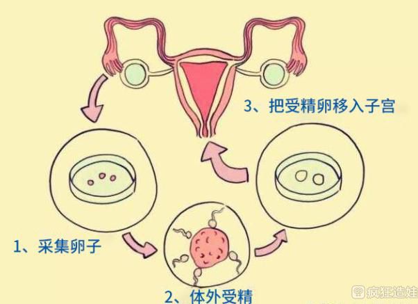 人工授精后可以吃榴莲吗