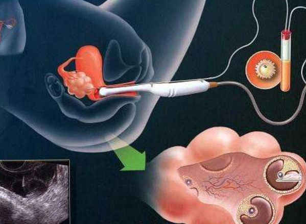 人工授精后可以吃榴莲吗