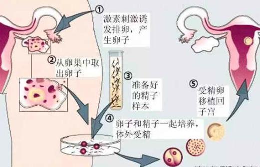 黑龙江哪些省份有提供精子的医院