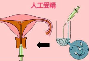 哈尔滨试管代怀违法费用表医院排名较好的是哪家+附哈尔滨试管三代机构助孕男孩名单