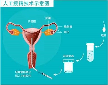 哈尔滨哈尔滨市哪家医院借卵试管代怀好吗比较好