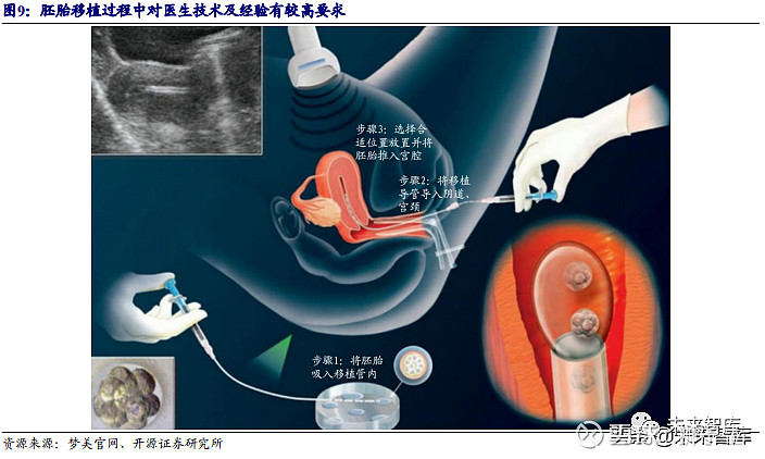 黑龙江供卵不排队医院婴儿一般多少钱（要花费27378元）