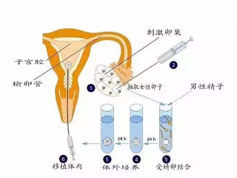 这4种妇科病会影响靠谱供卵机构,希望你不要有这些病+