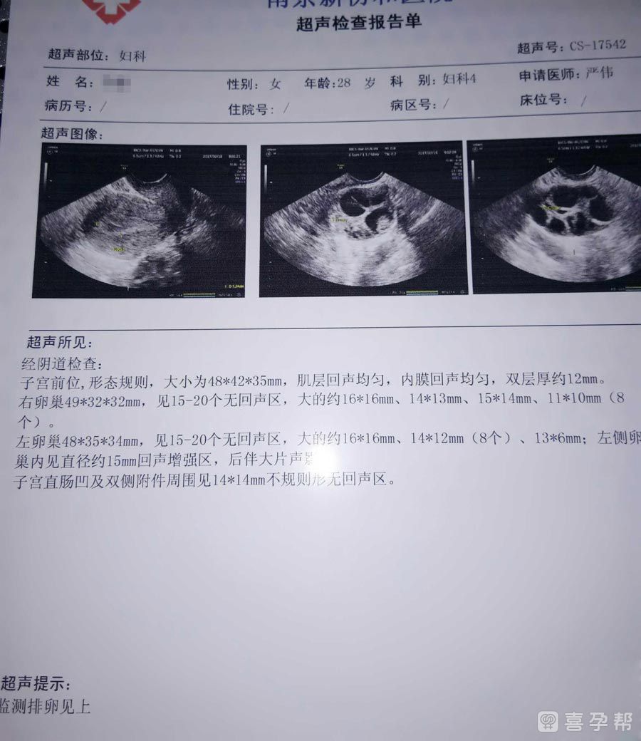 黑龙江一院三代试管助孕医院成功率怎么样（附哈尔滨天楚代怀网排名）
