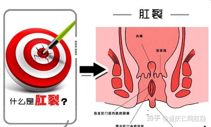 国内借别人的卵子做二代三代试管生子医院费